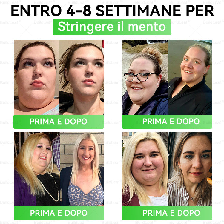 Negozio ufficiale | BuildLeaf® GLP-1 8-in-1 Fit & Vital Soluzione Orale (Solo una volta al giorno, cambiamenti visibili in 7 giorni) ✅ Per obesità, salute cardiovascolare, diabete, apnea notturna, salute intestinale, problemi articolari e altro