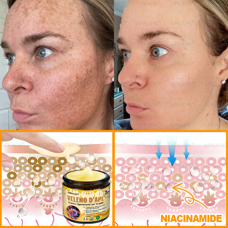 Prodotto e spedito in Italia 🫧 𝖠𝖯𝖪𝖠𝖯𝖪® Crema Ripristino Pelle al Veleno d'Api